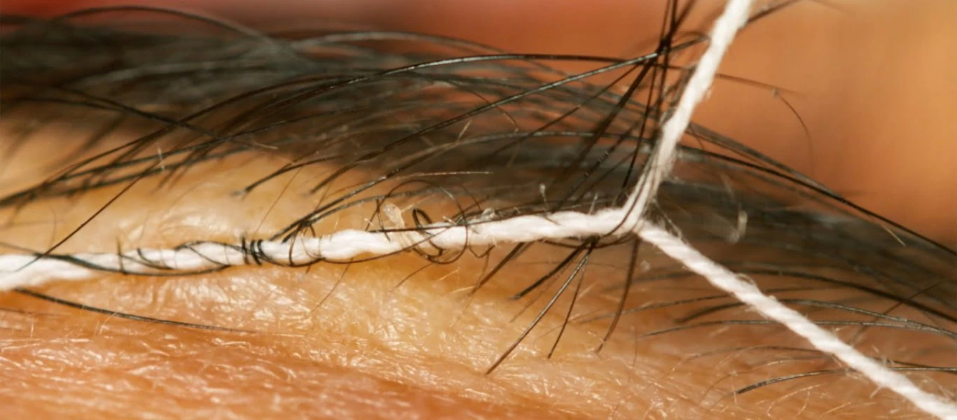 YouTuber κατέγραψε σε υπερ-κοντινά πλάνα μια... αποτρίχωση φρυδιών (βίντεο)